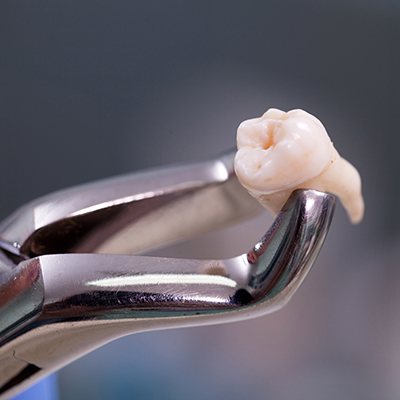 extracted tooth in tool