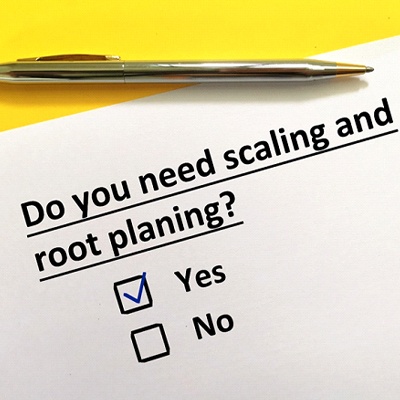 “Do you need scaling and root planing?” question printed on paper