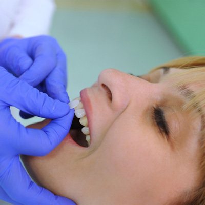 Patient receiving veneers in Reynoldsburg, OH from dentist